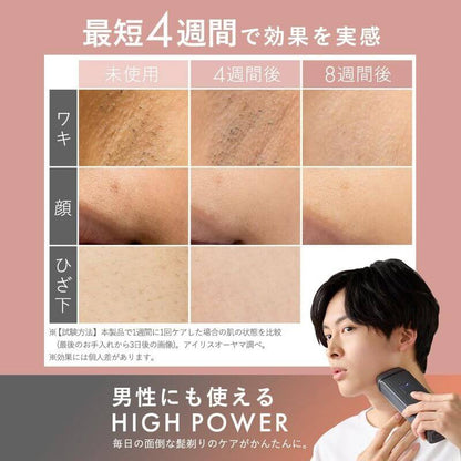 MiCOLA Light Hair Removal Device, AC100-240V LB-M101-W