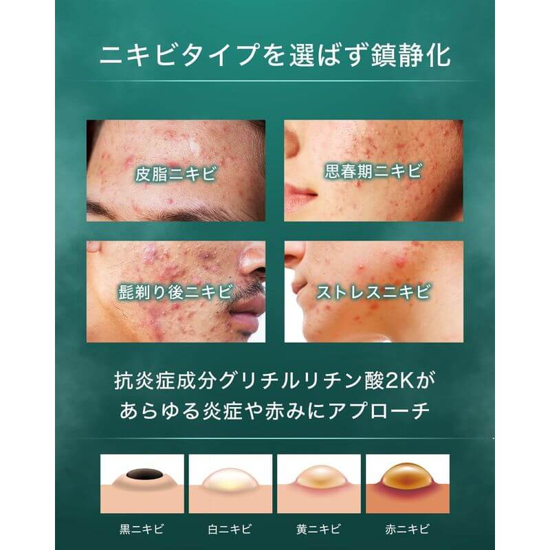 痘痘護理凝乳 尤加利薄荷 50g