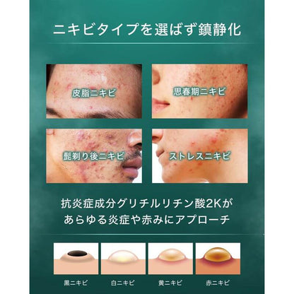 痘痘護理凝乳 尤加利薄荷 50g