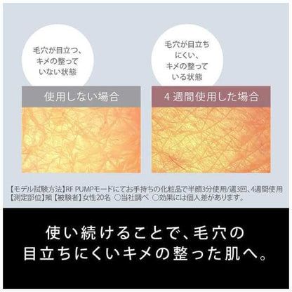 VITALIFT RF Skin Care Device EH-SR85-K - imy Shop Japan