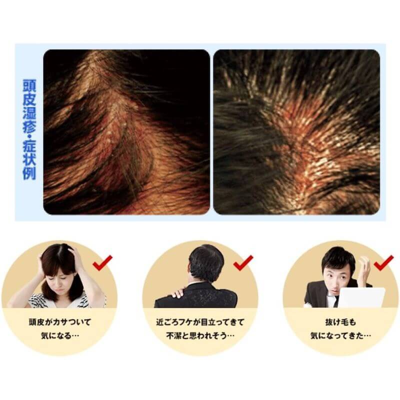 Mediquick H 清爽型SPA 頭皮洗髮精