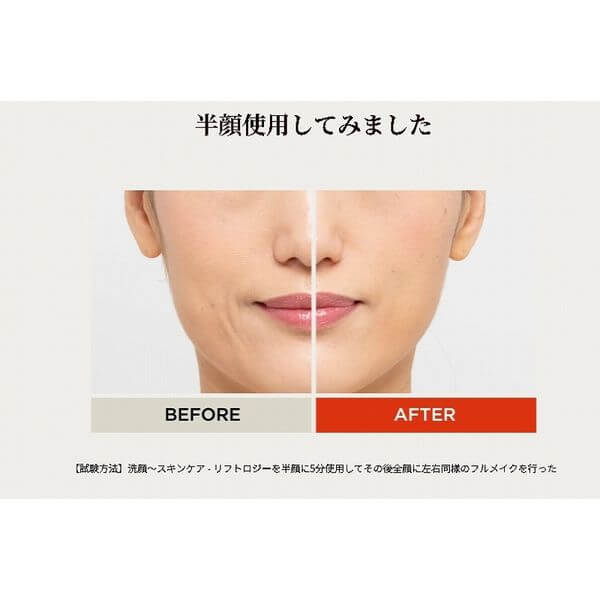Liftology Lift-Care Beauty Device YJFD1N - imy Shop Japan