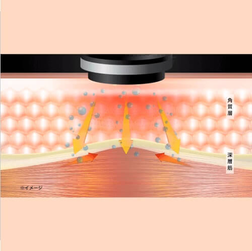 RF Beauty Device Photo PLUS Shiny NEO YJFM18N - imy Shop Japan