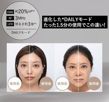 RF Beauty Device Photo PLUS Shiny NEO YJFM18N - imy Shop Japan